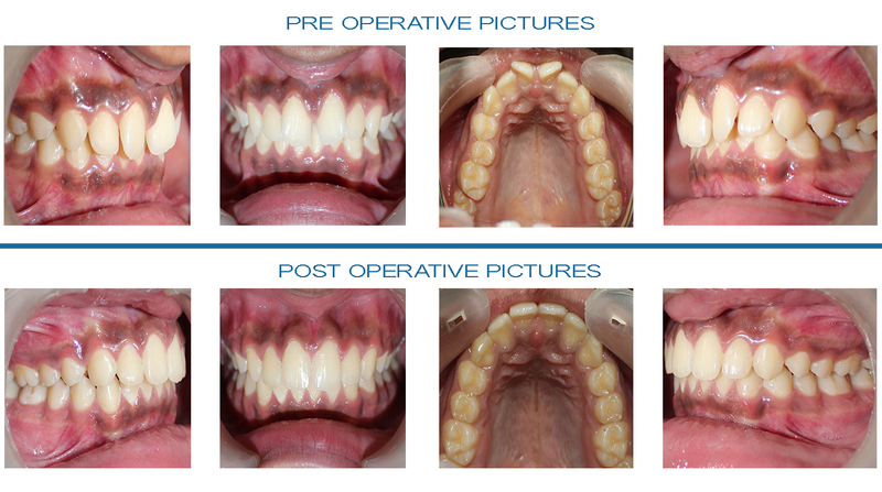  - Image 1