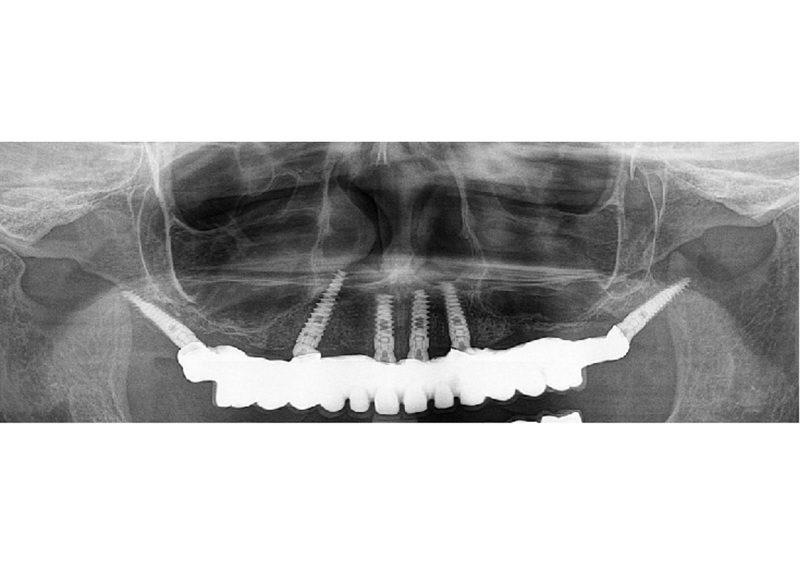  - Image 4