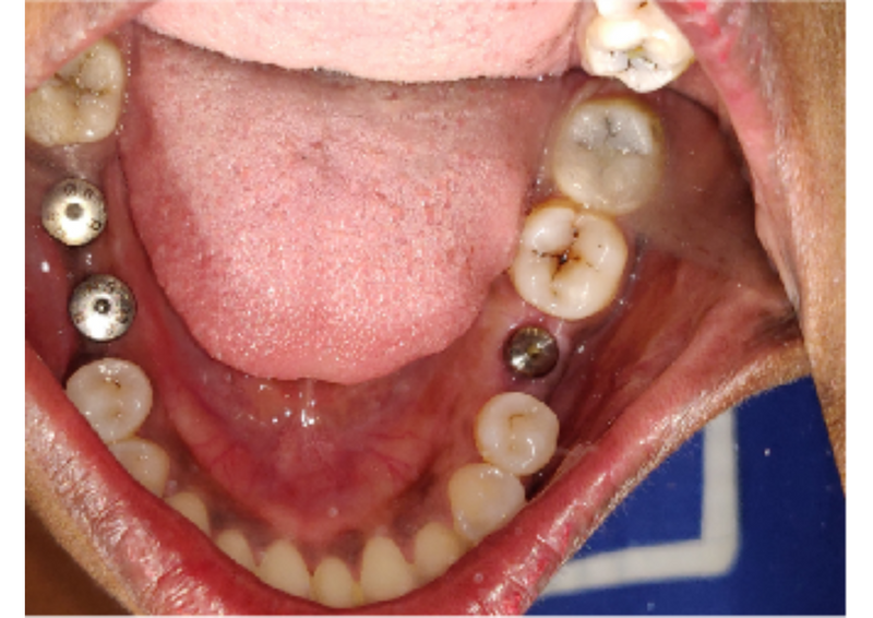  - Image 3