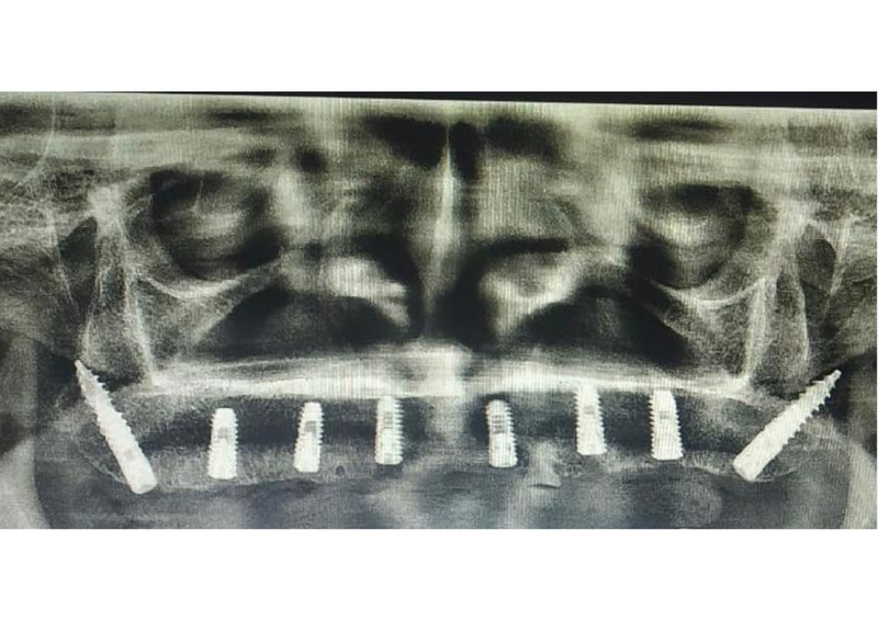  - Image 2