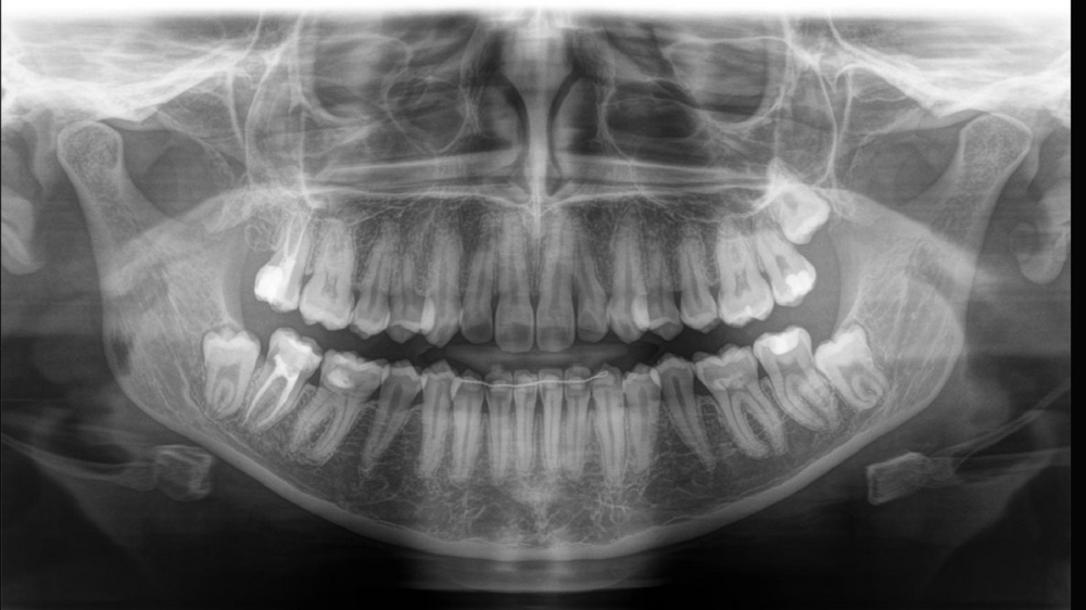 DentX3D Scanner